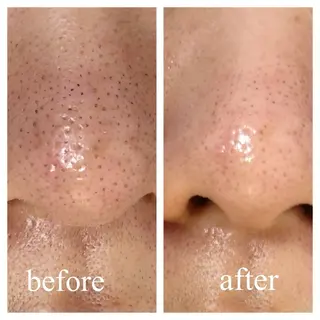 コアラル恵比寿店 chiakiのエステ・リラクイメージ