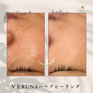 ニキビ改善専門店 d'Albaのエステ・リラクイメージ