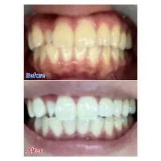 MBEAUTYSALON 千葉店・京成大久保所属・Melty 輝のその他イメージ