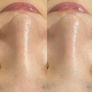 ๐๐๐๐ก๐ ๐๐ฒ ๐๐๐ฒ๐ฎๆๅฑใปใใผใใใผใชใณใฐ๐ฟ ๐ด๐๐๐ใฎใจในใใปใชใฉใฏใคใกใผใธ