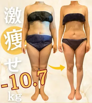 ハイパーナイフ/痩身 🌸CHARME原井のエステ・リラクイメージ