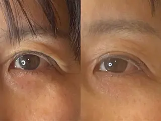 最速小顔・肌質管理 espoirマキのエステ・リラクイメージ