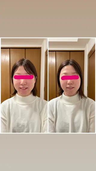 透明感の肌Lino malieのエステ・リラクイメージ