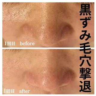 フェイシャル専門サロ ン ERINのエステ・リラクイメージ