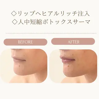 小顔/たるみ/黒ずみ除去専門サロン/SONA 大和西大寺店所属・【小顔専門看護師 サロンSONA】のエステ・リラクイメージ