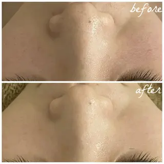 メンズ メナード岐阜茜部 杉浦のエステ・リラクイメージ