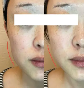 moe beauty salon所属・moe sayuriのエステ・リラクイメージ