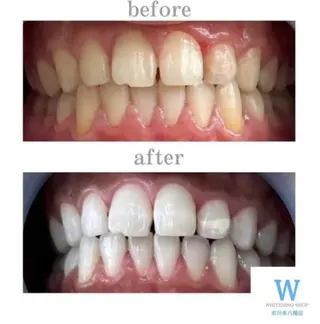 ホワイトニング ショップ本八幡店のエステ・リラクイメージ