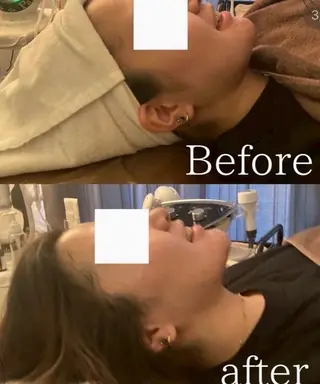 NICOLAUGH/ 村松【小顔.ボディ】のエステ・リラクイメージ