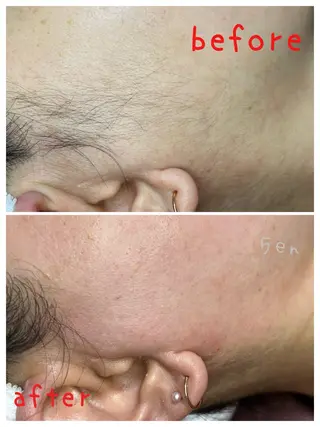 シュガーリング/脱毛 EARLS三軒茶屋のエステ・リラクイメージ