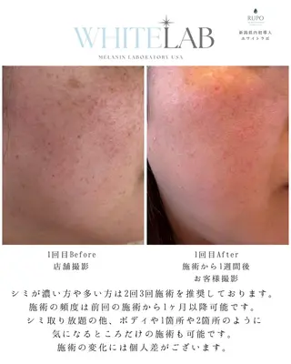 RUPO THE MAINTENANCE新潟店【ローマピンク公式認定店/ララピール正規店/骨格小顔】所属・オーナー Nanjoのエステ・リラクイメージ