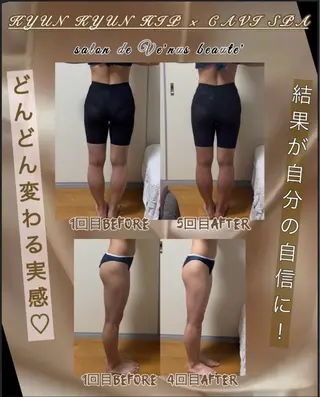 ヴィーナス ビューティーのエステ・リラクイメージ