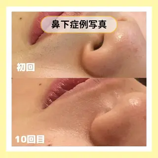 金山/脱毛/美肌 ULULUのエステ・リラクイメージ