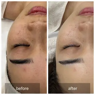 すっぴんたまご肌 平木さやかのエステ・リラクイメージ