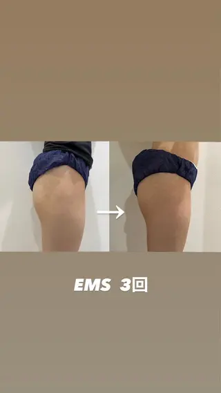 秒速小顔  恵比寿店所属・秒速小顔 恵比寿店 店長 さきのエステ・リラクイメージ