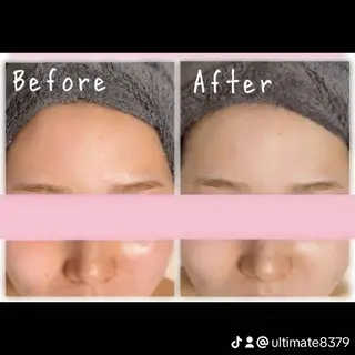 フェイシャルサロン ultimateのエステ・リラクイメージ