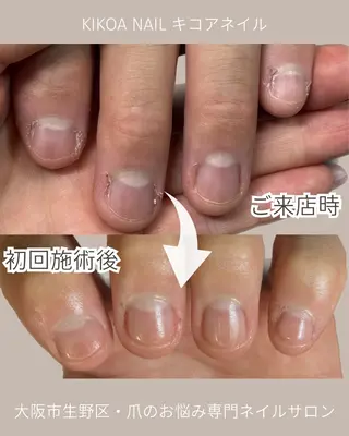 ネイル KIKOA NAIL キコアネイルのネイルデザイン