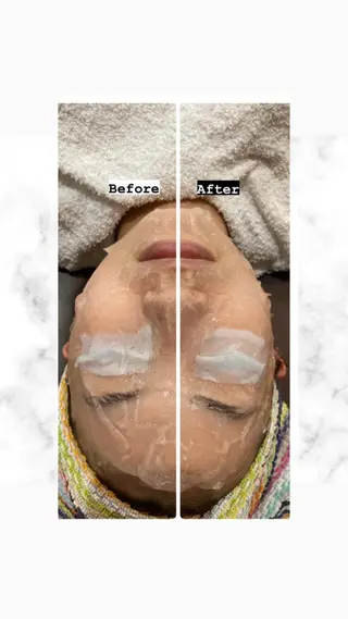 美顔秘密基地新宮所属・美顔秘密基地 新宮のその他イメージ