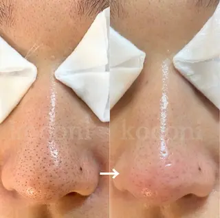 Mimi所属・大人のエステケア専門 ／ココニのエステ・リラクイメージ