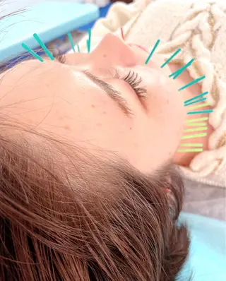 小顔美容鍼専門サロン 渋谷YZのエステ・リラクイメージ