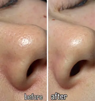 Salon Nicoli所属・歯科衛生士セラピスト MAKOのエステ・リラクイメージ