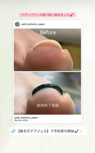 ネイル ZERO Nail Art Foot専用のネイルデザイン