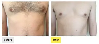 メンズ 都度払い脱毛⭐️ 脱毛サロンMIRACのエステ・リラクイメージ