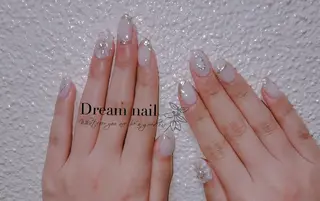 ネイル フィルイン、長さ出し 深爪矯正のネイルデザイン