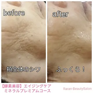 若返り 美肌   エステサロンららんのエステ・リラクイメージ