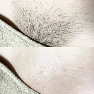 &me ayakaのエステ・リラクイメージ