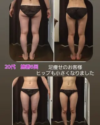 【美痩せ専門店】ビープロデュース豊田店所属・ビープロデュース 山下幸恵のエステ・リラクイメージ