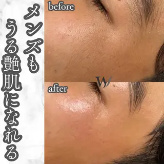 メンズ ホワイトワックス名古屋金山店所属・ホワイトワックス 金山店のエステ・リラクイメージ