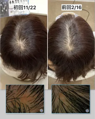 頭皮アンチエイジング L＋　秋葉原上野のエステ・リラクイメージ