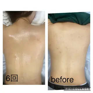 BLANC.【新宿店】所属・ハーブピーリング ayamiのエステ・リラクイメージ