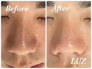 メンズ メンズフェイシャル アイブロウ・ルースのエステ・リラクイメージ