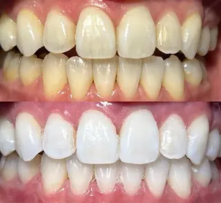 io teeth careのその他イメージ