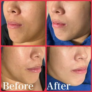 skin make salon -Olu's-所属・毛穴・肌質改善サロン ✨Tomaのその他イメージ