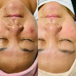 EARTH coiffure beaute 小山店所属・EARTH 小山店 shimaのエステ・リラクイメージ