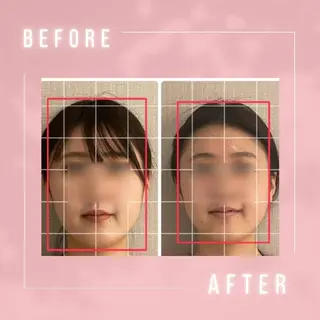 小顔・肌悩み専門店 ボーテドリッシュのエステ・リラクイメージ