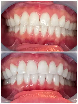 Monreve所属・美人スイッチdiet スーパージェクションのその他イメージ