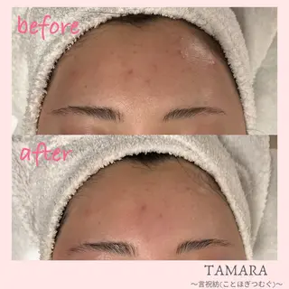 TAMARA 松下のエステ・リラクイメージ