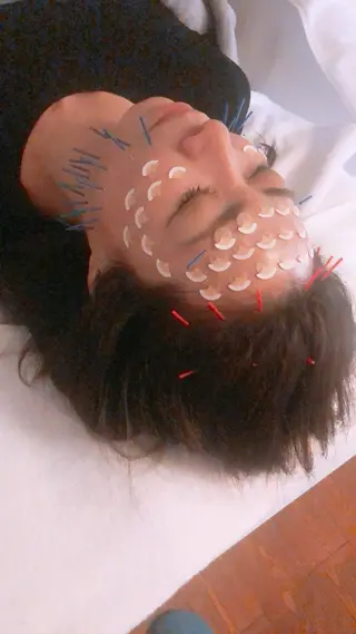 美容鍼灸女性専用 りんご鍼灸治療院のエステ・リラクイメージ