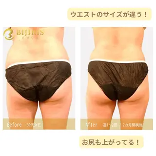 セルフ脱毛/美尻イス キングスサロン熊本のエステ・リラクイメージ