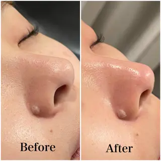 エステ脱毛 MAIのエステ・リラクイメージ