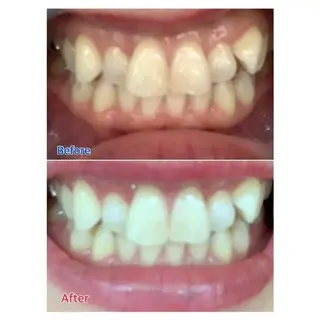 M渋谷店所属・Ｍ渋谷 ホワイトニングのその他イメージ