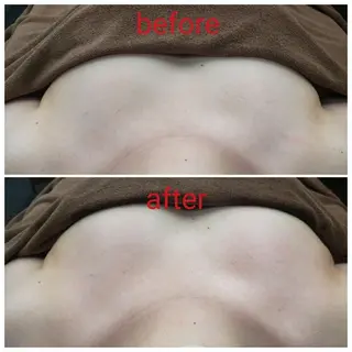 痩身・脱毛・美髪ケア 【GLYCINE】のエステ・リラクイメージ