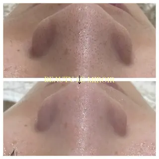 ビューティー ミロワールのエステ・リラクイメージ