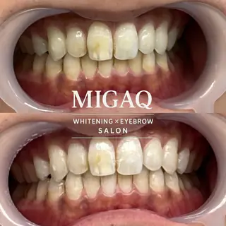歯のホワイトニング専門店 MIGAQ 京都四条大宮店所属・佐藤 未来の眉毛・アイブロウイメージ