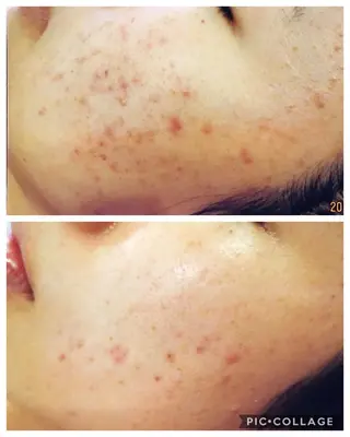 ジョリ   ヴェール 山口のマツエク・マツパデザイン