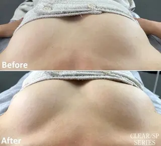 脱毛専門サロンELIXIR（ｴﾘｸｻｰ）所属・脱毛&ホワイトニング ELIXIR×ULTのエステ・リラクイメージ